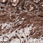 beta Actin Antibody in Immunohistochemistry (Paraffin) (IHC (P))