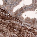 beta Actin Antibody in Immunohistochemistry (Paraffin) (IHC (P))