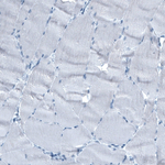 AFP Antibody in Immunohistochemistry (Paraffin) (IHC (P))