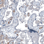 AFP Monoclonal Antibody (CL9766)