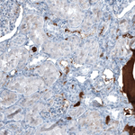 AFP Antibody in Immunohistochemistry (Paraffin) (IHC (P))