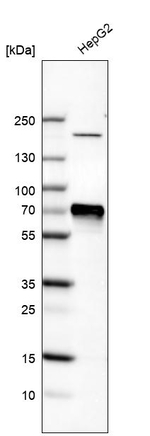 AFP Antibody in Western Blot (WB)