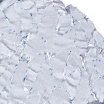 AFP Antibody in Immunohistochemistry (Paraffin) (IHC (P))