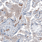 AFP Antibody in Immunohistochemistry (Paraffin) (IHC (P))