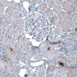 AFP Antibody in Immunohistochemistry (Paraffin) (IHC (P))