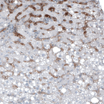 AFP Antibody in Immunohistochemistry (Paraffin) (IHC (P))