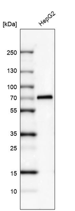 AFP Antibody in Western Blot (WB)