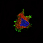 beta Catenin Antibody in Immunocytochemistry (ICC/IF)
