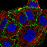 beta Catenin Monoclonal Antibody (CL3691)