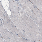 beta Catenin Antibody in Immunohistochemistry (Paraffin) (IHC (P))