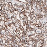 beta Catenin Antibody in Immunohistochemistry (Paraffin) (IHC (P))