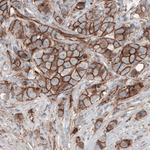 beta Catenin Antibody in Immunohistochemistry (Paraffin) (IHC (P))