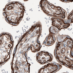 beta Catenin Antibody in Immunohistochemistry (Paraffin) (IHC (P))