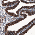 beta Catenin Antibody in Immunohistochemistry (Paraffin) (IHC (P))