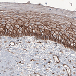 beta Catenin Antibody in Immunohistochemistry (Paraffin) (IHC (P))