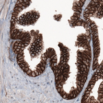 beta Catenin Antibody in Immunohistochemistry (Paraffin) (IHC (P))
