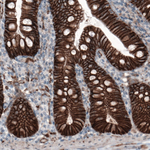 beta Catenin Antibody in Immunohistochemistry (Paraffin) (IHC (P))