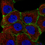 beta Catenin Monoclonal Antibody (CL3689)