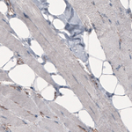 beta Catenin Antibody in Immunohistochemistry (Paraffin) (IHC (P))