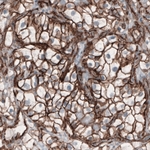 beta Catenin Antibody in Immunohistochemistry (Paraffin) (IHC (P))
