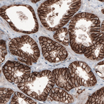 beta Catenin Antibody in Immunohistochemistry (Paraffin) (IHC (P))