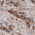 beta Catenin Antibody in Immunohistochemistry (Paraffin) (IHC (P))