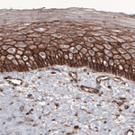 beta Catenin Antibody in Immunohistochemistry (Paraffin) (IHC (P))