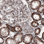 beta Catenin Antibody in Immunohistochemistry (Paraffin) (IHC (P))