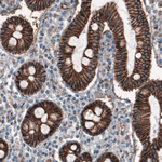 beta Catenin Antibody in Immunohistochemistry (Paraffin) (IHC (P))