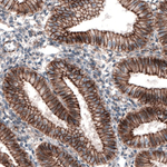 beta Catenin Antibody in Immunohistochemistry (Paraffin) (IHC (P))