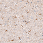 IBA1 Antibody in Immunohistochemistry (Paraffin) (IHC (P))