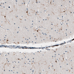 IBA1 Antibody in Immunohistochemistry (Paraffin) (IHC (P))