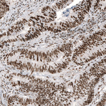 c-Jun Antibody in Immunohistochemistry (Paraffin) (IHC (P))