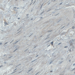 CD105 Antibody in Immunohistochemistry (Paraffin) (IHC (P))