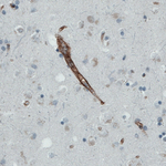 CD105 Antibody in Immunohistochemistry (Paraffin) (IHC (P))