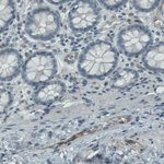 CD105 Antibody in Immunohistochemistry (Paraffin) (IHC (P))
