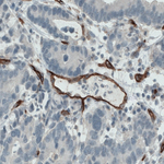 CD105 Monoclonal Antibody (CL1912)
