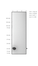 VSNL1 Recombinant Rabbit Monoclonal Antibody (FH17)