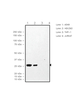 TPI1 Recombinant Rabbit Monoclonal Antibody (TH06)
