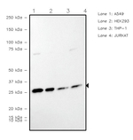 TPI1 Recombinant Rabbit Monoclonal Antibody (UH45)