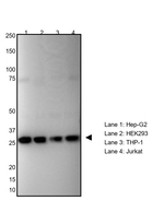 TPI1 Recombinant Rabbit Monoclonal Antibody (WH29)