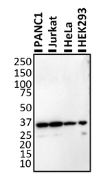 HSP40 Antibody in Western Blot (WB)