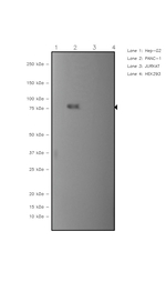 Gelsolin Recombinant Rabbit Monoclonal Antibody (JJ49)