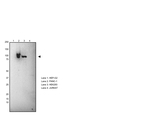 Gelsolin Recombinant Rabbit Monoclonal Antibody (JJ62)