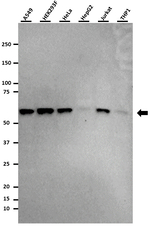 FTO Antibody in Western Blot (WB)