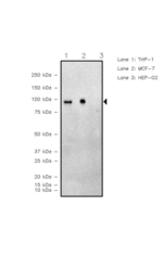 PDCD6IP Antibody in Western Blot (WB)