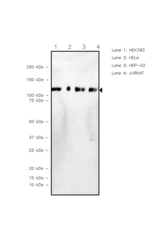 UBA1 Recombinant Rabbit Monoclonal Antibody (RN05)