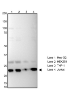 ARF1 Recombinant Rabbit Monoclonal Antibody (TF89)
