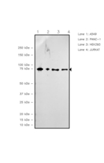 Ezrin Recombinant Rabbit Monoclonal Antibody (UL79)