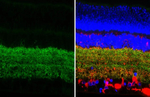 GAT-1 Antibody in Immunohistochemistry (Paraffin) (IHC (P))